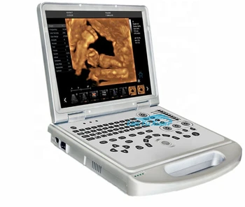 BPM-CU2 צבע 4D רפואי נייד, מכונת אולטרסאונד סורק מחיר